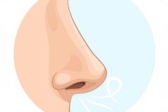 为什么做完耳软骨隆鼻/鼻部多项后鼻尖显形了?怎么办?